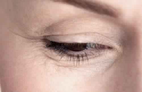 rides-sous-les-yeux