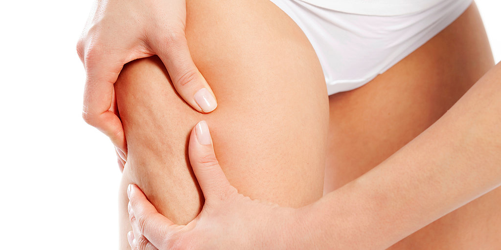 types-de-cellulite1