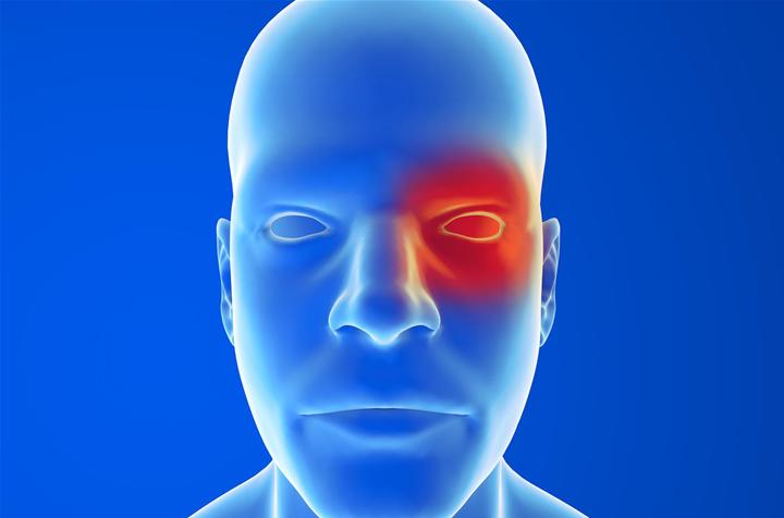 Leucopathie Vasculaire Et Maux De Tête